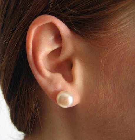 droopy ear lobe lift